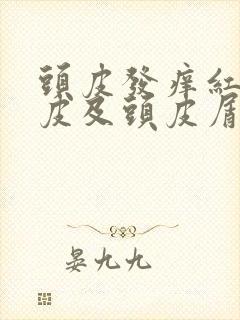 头皮发痒红斑头皮及头皮屑