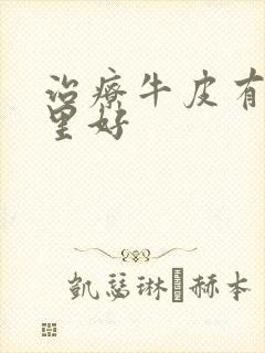 治疗牛皮有癣哪里好