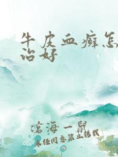 牛皮血癣怎么能治好