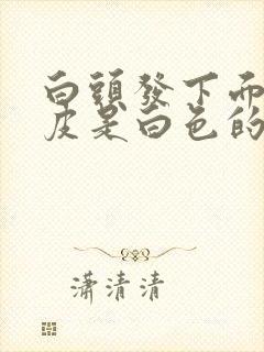 白头发下面的头皮是白色的是什么原因