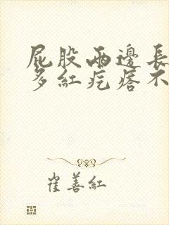 屁股两边长了很多红疙瘩不痛不痒