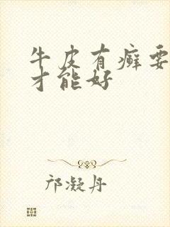 牛皮有癣要多久才能好