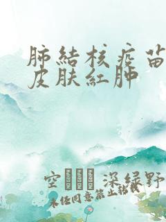 肺结核疫苗打完皮肤红肿