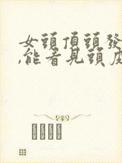 女头顶头发稀少,能看见头皮了,怎么办啊