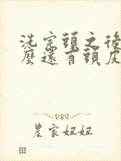 洗完头之后为什么还有头皮屑