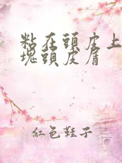 粘在头皮上的大块头皮屑