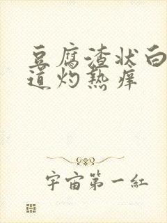 豆腐渣状白带阴道灼热痒