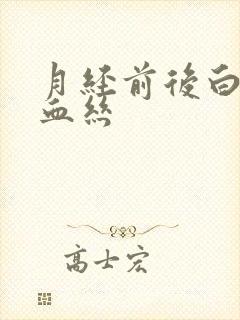 月经前后白带带血丝