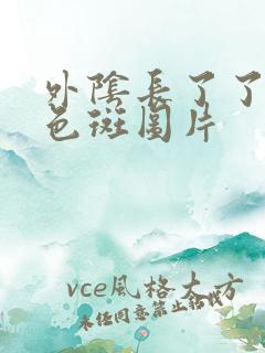 外阴长了了个白色斑图片