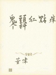 鬼头红点痒挂哪个科