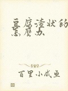 豆腐渣状的白带怎么办