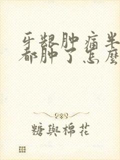 牙龈肿痛半边脸都肿了怎么快速消肿