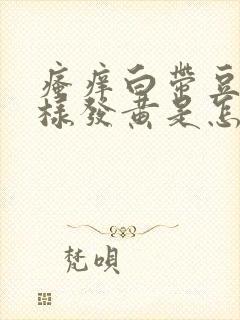 瘙痒白带豆腐渣样发黄是怎么回事