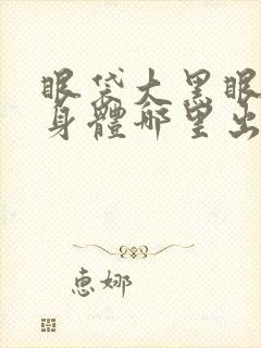 眼袋大黑眼圈是身体哪里出现了问题