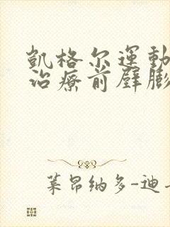 凯格尔运动可以治疗前壁膨出吗