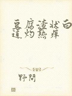 豆腐渣状白带阴道灼热痒