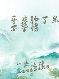 牙疼肿了半边脸要警惕