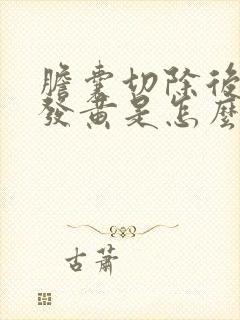 胆囊切除后小便发黄是怎么回事