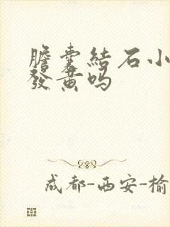 胆囊结石小便会发黄吗