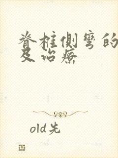 脊椎侧弯的症状及治疗