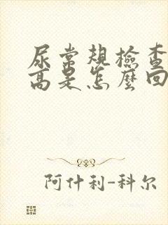 尿常规检查细菌高是怎么回事女性