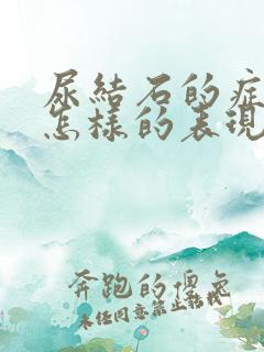 尿结石的症状是怎样的表现