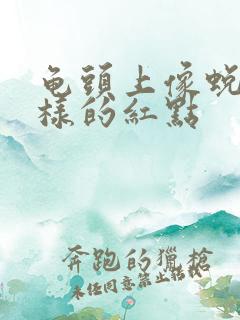 龟头上像蜕皮一样的红点