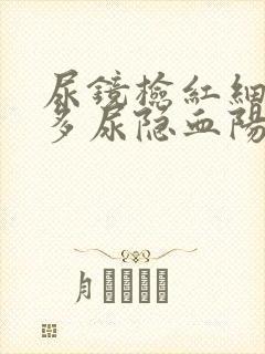 尿镜检红细胞增多尿隐血阳性是啥意思