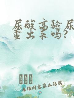 尿酸高验尿能检查出来吗?