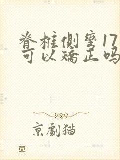 脊椎侧弯17岁可以矫正吗