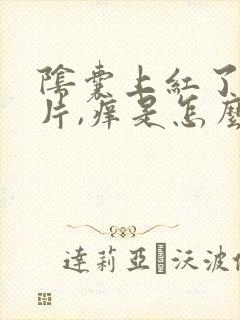 阴囊上红了一小片,痒是怎么回事