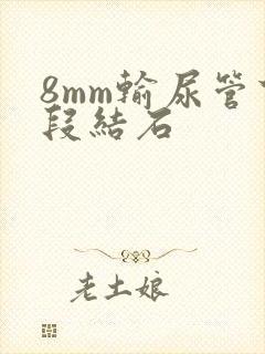 8mm输尿管下段结石