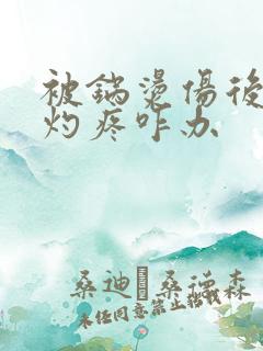 被锅烫伤后一直灼疼咋办