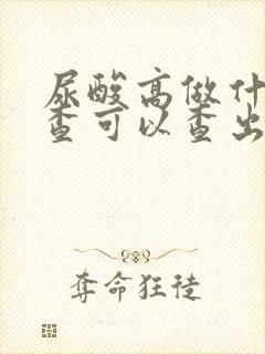 尿酸高做什么检查可以查出来