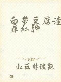 白带豆腐渣外阴痒红肿