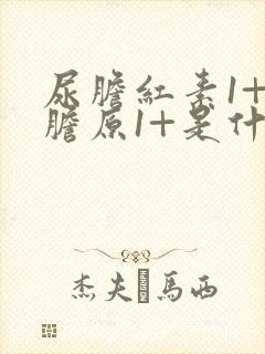 尿胆红素1+尿胆原1+是什么意思