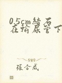 0.5cm结石在输尿管下段卡住怎么办