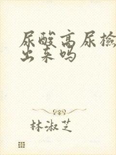 尿酸高尿检能查出来吗