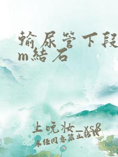 输尿管下段4mm结石