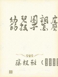 幼儿园调皮好动的孩子怎么教育