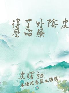 得了外阴皮癣怎么治疗