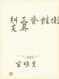 纠正脊椎侧弯的支具