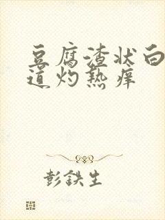 豆腐渣状白带阴道灼热痒