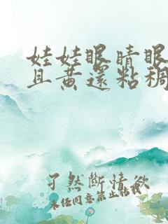 娃娃眼睛眼屎多且黄还粘稠