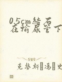 0.5cm结石在输尿管下段卡住怎么办