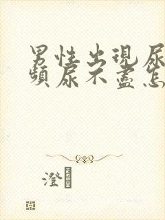 男性出现尿急尿频尿不尽怎么办