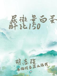 尿微量白蛋白肌酐比150