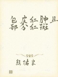 包皮红肿且龟头部分红斑