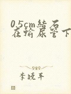 0.5cm结石在输尿管下段卡住怎么办