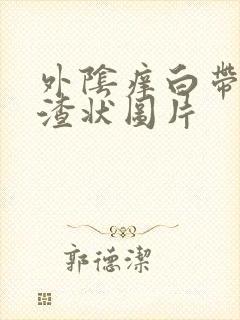 外阴痒白带豆腐渣状图片